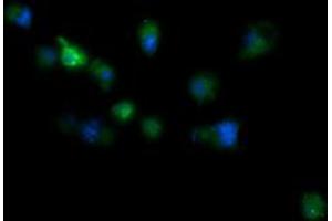 Image no. 1 for anti-RIO Kinase 2 (RIOK2) (AA 277-552) antibody (ABIN1491305) (RIOK2 抗体  (AA 277-552))