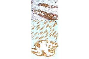 Immunohistochemical staining (Formalin-fixed paraffin-embedded sections) of (A) human skin (B) rat stomach and (C) rat oviduct with KRT76 monoclonal antibody, clone KRTH/1076 . (Cytokeratin 2 抗体)