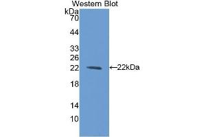 Western Blotting (WB) image for anti-Bleomycin Hydrolase (BLMH) (AA 30-165) antibody (ABIN1175602) (BLMH 抗体  (AA 30-165))