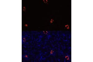 Immunofluorescence (IF) image for anti-Aquaporin 2 (Collecting Duct) (AQP2) (AA 147-271) antibody (ABIN7265652)