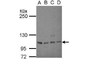 WB Image Sample (30 ug of whole cell lysate) A: 293T B: A431 C: HeLa D: HepG2 5% SDS PAGE antibody diluted at 1:1000