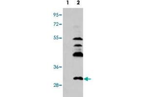Western blot analysis of UCK2 (arrow) using UCK2 polyclonal antibody . (UCK2 抗体  (C-Term))