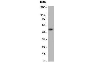 Western blot testing of ANGPTL3 antibody and A549 cell lysate (ANGPTL3 抗体  (N-Term))