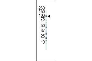 Western Blotting (WB) image for anti-Fibroblast Growth Factor Receptor 3 (FGFR3) (AA 776-806), (C-Term) antibody (ABIN391969)