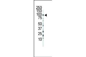 Western blot analysis of anti-FGFR3 Pab (ABIN391969 and ABIN2841765) in Jurkat cell lysate. (FGFR3 抗体  (C-Term))