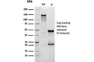 Western Blotting (WB) image for anti-Vimentin (VIM) (AA 2-466) antibody (ABIN6940884)