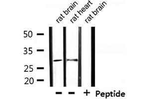 Western Blotting (WB) image for anti-Tumor Necrosis Factor Receptor Superfamily, Member 9 (TNFRSF9) (Internal Region) antibody (ABIN6256873)