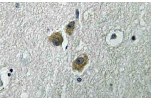 Immunohistochemistry (IHC) analyzes of ME3 antibody in paraffin-embedded human brain tissue. (ME3 抗体)