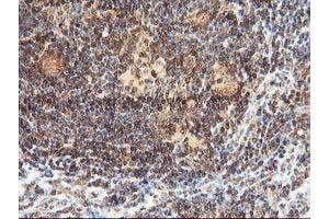 Image no. 7 for anti-Leucine Carboxyl Methyltransferase 1 (LCMT1) antibody (ABIN1499109) (LCMT1 抗体)