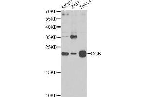 Western blot analysis of extracts of various cell lines, using CGB Antibody. (Chorionic Gonadotropin, beta Polypeptide 3 (CGB3) 抗体)