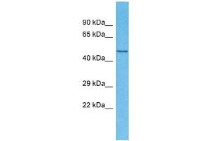 Host: Rabbit Target Name: TMEM194A Sample Type: Fetal Kidney lysates Antibody Dilution: 1. (TMEM194A 抗体  (N-Term))