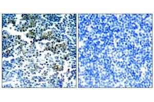 Immunohistochemical analysis of paraffin-embedded human tonsil tumor tissue, using Bcr (phospho-Tyr177) antibody (E011199). (BCR 抗体  (pTyr177))
