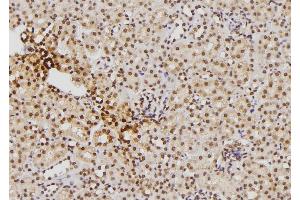 Immunohistochemistry (IHC) image for anti-S100 Calcium Binding Protein B (S100B) (C-Term) antibody (ABIN6264909)