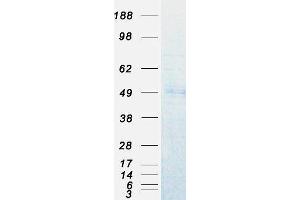 Validation with Western Blot