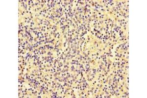 Immunohistochemistry of paraffin-embedded human spleen tissue using ABIN7176672 at dilution of 1:100 (SLC3A1 抗体  (AA 58-278))