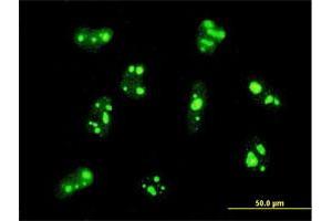 Immunofluorescence of monoclonal antibody to PER2 on HeLa cell. (PER2 抗体  (AA 1-100))