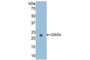 Detection of Recombinant FTMT, Mouse using Polyclonal Antibody to Ferritin, Mitochondrial (FTMT) (Ferritin Mitochondrial 抗体  (AA 54-229))