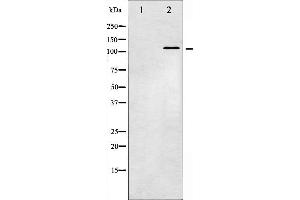 Western blot analysis of JAK2 phosphorylation expression in K562 whole cell lysates,The lane on the left is treated with the antigen-specific peptide. (JAK2 抗体  (pTyr221))