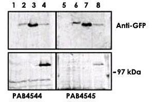 Upper panel, western blot analysis of GFP fusion protein expression in Panc-1 cells by using an PRKD3 polyclonal antibody  . (PRKD3 抗体  (C-Term))