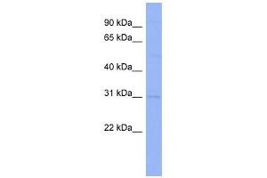 Claudin 18 antibody used at 1 ug/ml to detect target protein. (Claudin 18 抗体  (Middle Region))