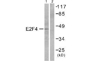 Western blot analysis of extracts from COS7 cells, usingantibody (#C0178). (E2F4 抗体)