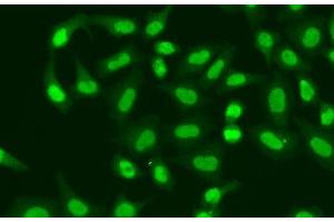 Immunofluorescence analysis of A549 cells using APTX Polyclonal Antibody (Aprataxin 抗体)