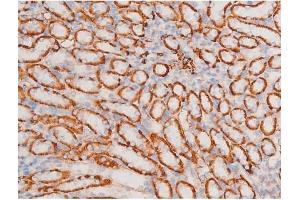 Immunohistochemistry (IHC) image for anti-X-Linked Inhibitor of Apoptosis (XIAP) (pSer87) antibody (ABIN6256441)