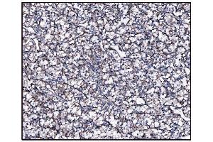 IHC analysis of FABP-1/GOT2 using anti-FABP-1/GOT2 antibody (ABIN7601426). (GOT2 抗体  (AA 35-430))