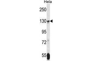 TNKS Antibody (N-term) western blot analysis in Hela cell line lysates (35 µg/lane). (TNKS 抗体  (N-Term))