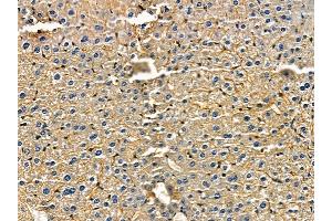 WBSCR22 Antibody at 1/100 staining mouse skin tissue by IHC-P. (WBSCR22 抗体)