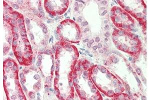Rabbit Anti-SV2A antibody  Formalin Fixed Paraffin Embedded Tissue: Human Kidney Primary antibody Concentration: 1:100 Secondary Antibody: Donkey anti-Rabbit-Cy3 Secondary Antibody Concentration: 1:200 Magnification: 20x Exposure Time: 0. (SV2A 抗体  (Middle Region))
