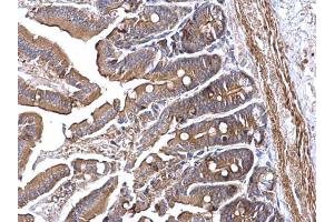 IHC-P Image RRM2 antibody [N1C1] detects RRM2 protein at cytoplasm on mouse intestine by immunohistochemical analysis. (RRM2 抗体  (Regulatory Subunit))
