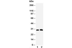 Western blot testing of Aquaporin 5 antibody and Lane 1:  rat lung (Aquaporin 5 抗体  (C-Term))