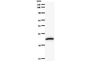 Western Blotting (WB) image for anti-Translin-Associated Factor X (TSNAX) antibody (ABIN932466) (TSNAX 抗体)