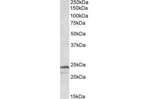 Western Blotting (WB) image for anti-Proteasome Subunit beta 3 (PSMB3) (Internal Region) antibody (ABIN2464725) (PSMB3 抗体  (Internal Region))