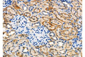 ABIN6262943 and ABIN6277882 at 1/100 staining Rat kidney tissue by IHC-P. (LDLR 抗体  (Internal Region))