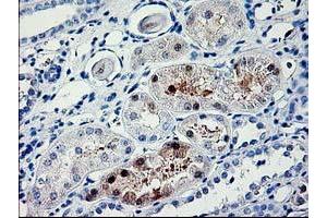 Immunohistochemical staining of paraffin-embedded Human Kidney tissue using anti-PDE6G mouse monoclonal antibody. (PDE6G 抗体)
