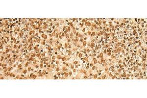 Immunohistochemistry of paraffin-embedded Human tonsil tissue using HIST1H2BA Polyclonal Antibody at dilution of 1:45(x200) (HIST1H2BA 抗体)