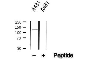 Western blot analysis of extracts from A431, using ITGA6 Antibody. (ITGA6 抗体  (N-Term))