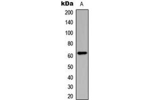 Western blot analysis of CHK2 (pT383) expression in HeLa (A) whole cell lysates. (CHEK2 抗体  (pSer383))