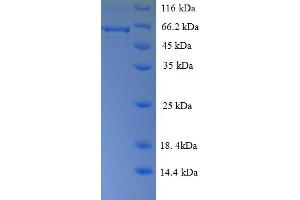 Regulator of G-Protein Signaling 7 (RGS7) (AA 1-487), (full length) protein (His tag)