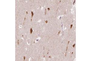 Immunohistochemical staining (Formalin-fixed paraffin-embedded sections) of human hippocampus with SCG3 polyclonal antibody  shows cytoplasmic positivity in neurons. (SCG3 抗体)