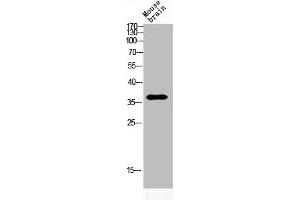 Western blot analysis of MOUSE-BRAIN lysis using ART1 antibody. (ART1 抗体  (Internal Region))