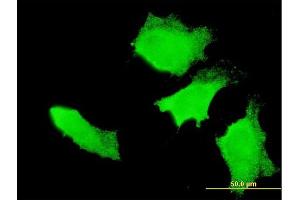Immunofluorescence of monoclonal antibody to APC on HeLa cell. (APC 抗体  (AA 2744-2843))
