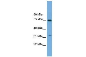 UBXD3 antibody used at 1 ug/ml to detect target protein. (UBXN10 抗体  (Middle Region))