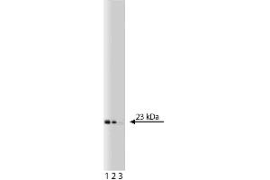 Western blot analysis of Bid on a Jurkat cell lysate (Human T-cell leukemia, ATCC TIB-152).