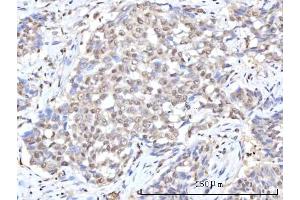 IHC analysis of RANBP2 using anti-RANBP2 antibody (ABIN7602650). (RANBP2 抗体  (AA 906-2744))