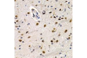 Immunohistochemistry of paraffin-embedded rat brain using ID3 antibody (ABIN5973111) at dilution of 1/200 (40x lens). (ID3 抗体)
