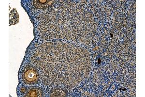 ABIN6265178 and ABIN6268693 at 1/100 staining Mouse ovary tissue by IHC-P. (SMAD7 抗体  (N-Term))