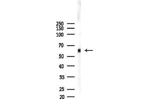 Western blot analysis of lysates from Mouse liver, using Caspase 10 Antibody at 1/1000 dilution.